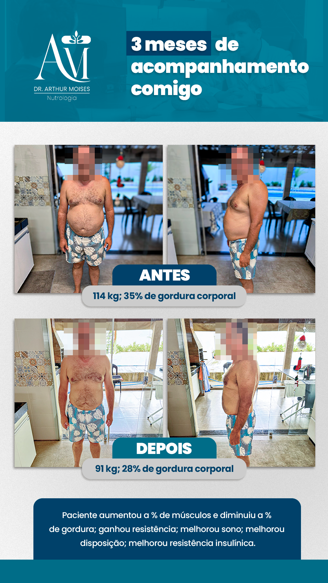 Antes e Depois_Versão 2