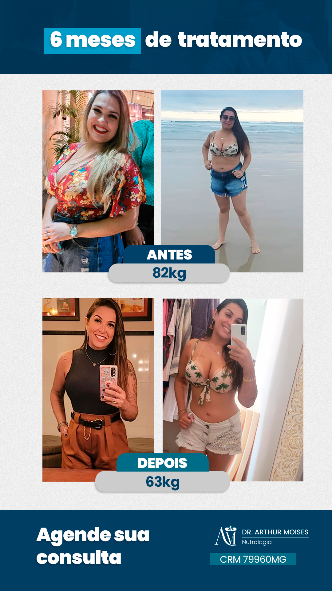 Story_AntesDepois_Paciente2